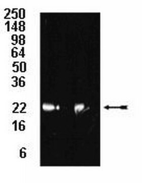 Anti-20S proteasome subunit &#946;5 Antibody serum, Upstate&#174;