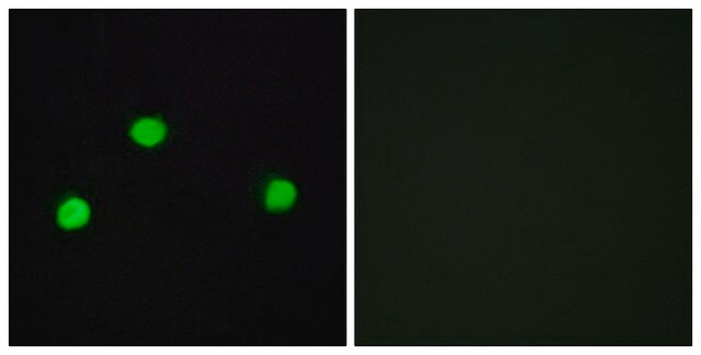 Anti-IP6K2 antibody produced in rabbit affinity isolated antibody