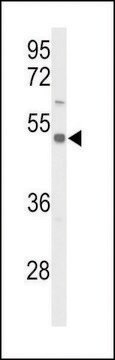 ANTI-S39A8 (CENTER) antibody produced in rabbit affinity isolated antibody, buffered aqueous solution