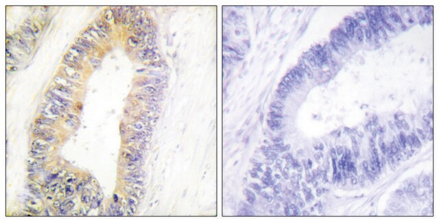 Anti-ZNF638 antibody produced in rabbit affinity isolated antibody