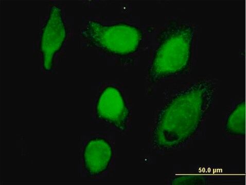 Anti-CAPN1 antibody produced in mouse purified immunoglobulin, buffered aqueous solution