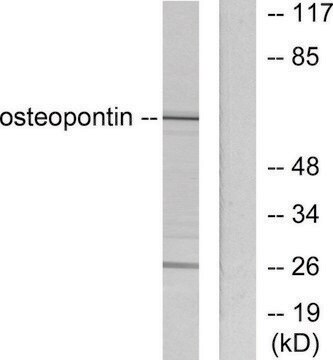 Anti-Osteopontin, C-Terminal antibody produced in rabbit affinity isolated antibody