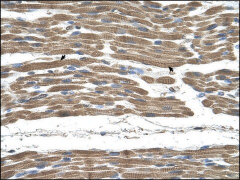 Anti-STIP1 (AB2) antibody produced in rabbit IgG fraction of antiserum