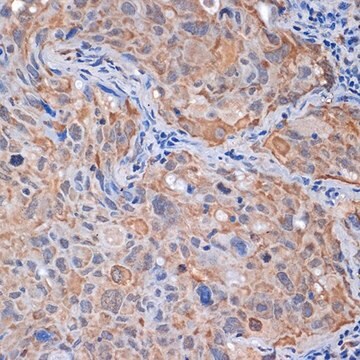 Anti-PP2A alpha + beta antibody produced in rabbit