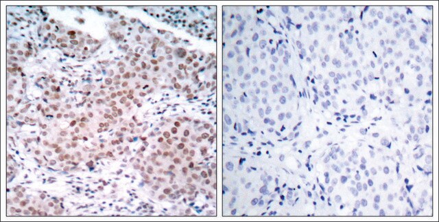 Anti-phospho-ESR1 (pSer104) antibody produced in rabbit affinity isolated antibody