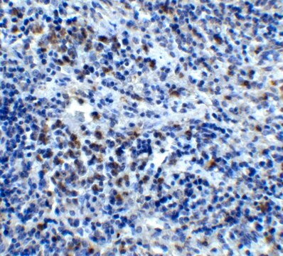 Anti-CXCR4 antibody produced in rabbit affinity isolated antibody