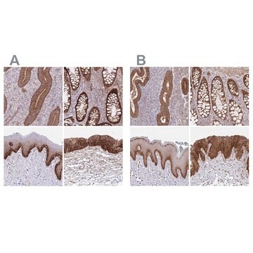 Anti-ITGA2 antibody produced in rabbit Prestige Antibodies&#174; Powered by Atlas Antibodies, affinity isolated antibody, buffered aqueous glycerol solution