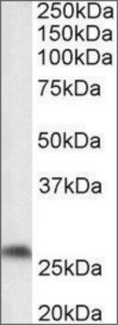 Anti-Ptgds antibody produced in goat affinity isolated antibody, buffered aqueous solution