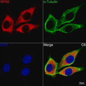 Anti-S6 Ribosomal Protein (RPS6) Antibody, clone 4C7P4, Rabbit Monoclonal