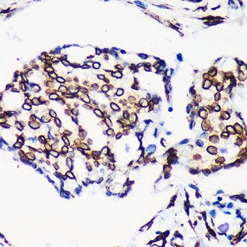 Anti- Lamin A/C antibody produced in rabbit