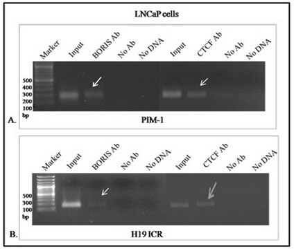 Anti-BORIS/CTCFL Antibody, clone 4A7 clone 4A7, from human(Recombinant)