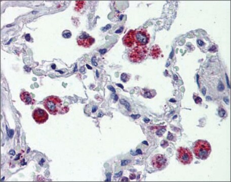 Anti-CYBB antibody produced in rabbit affinity isolated antibody