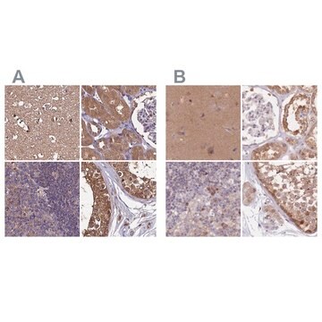 Anti-NAXE antibody produced in rabbit Prestige Antibodies&#174; Powered by Atlas Antibodies, affinity isolated antibody, buffered aqueous glycerol solution