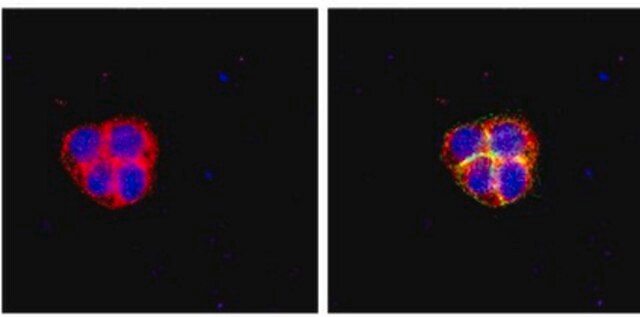 RIPAb+ Fragile X Mental Retardation Protein - RIP Validated Antibody and Primer Set from mouse