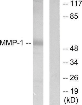 Anti-MMP-1 antibody produced in rabbit affinity isolated antibody