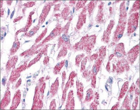 Anti-ACAT1 antibody produced in rabbit affinity isolated antibody