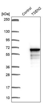 Anti-TSEN2 antibody produced in rabbit Prestige Antibodies&#174; Powered by Atlas Antibodies, affinity isolated antibody, buffered aqueous glycerol solution, ab3