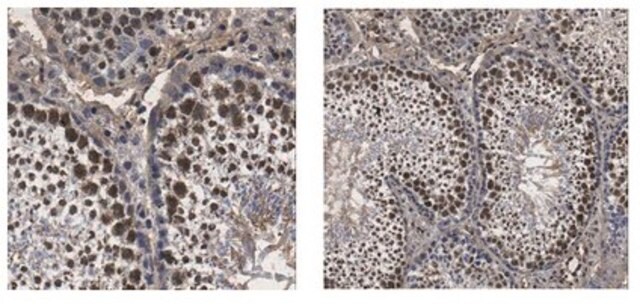 Anti-BRDT Antibody from rabbit, purified by affinity chromatography