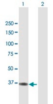 Anti-ACAD8 antibody produced in mouse purified immunoglobulin, buffered aqueous solution