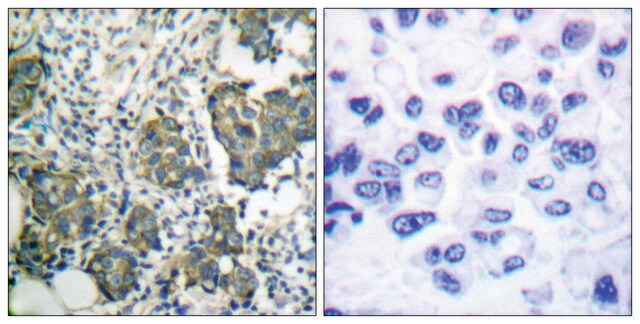 Anti-Keratin 8 antibody produced in rabbit affinity isolated antibody