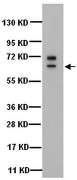 Anti-Cytokeratin 5 Antibody, 6, clone D5/16B4 clone D5/16B4, Chemicon&#174;, from mouse