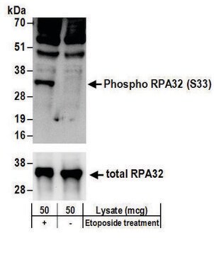 Rabbit anti-Phospho RPA32 (S33) Antibody, Affinity Purified