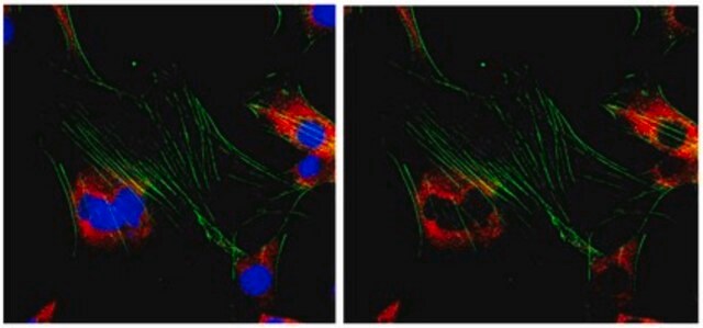 Anti-Ena/VASP-like protein Antibody from rabbit, purified by affinity chromatography