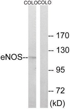 Anti-ENOS antibody produced in rabbit affinity isolated antibody