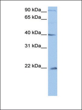 Anti-C4ORF33 antibody produced in rabbit affinity isolated antibody