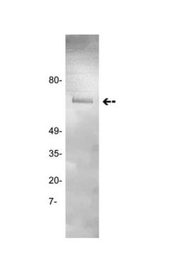 Anti-Prothrombin Antibody, clone GMA-095 clone GMA-095, Upstate&#174;, from mouse