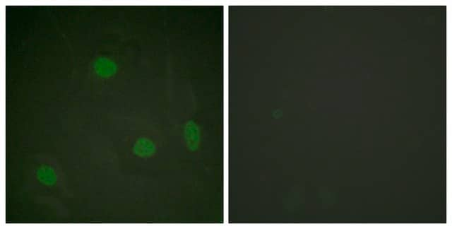 Anti-Histone H3 (Acetyl-Lys23) antibody produced in rabbit affinity isolated antibody