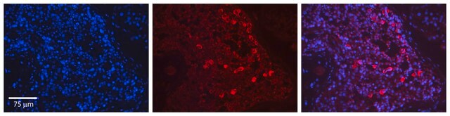 Anti-SIRT1 antibody produced in rabbit affinity isolated antibody