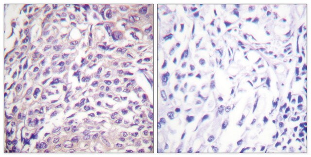 Anti-FOXO1A antibody produced in rabbit affinity isolated antibody