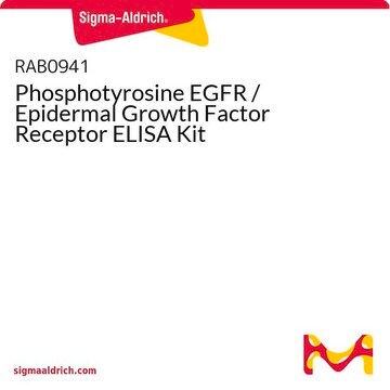 Phosphotyrosine EGFR / Epidermal Growth Factor Receptor ELISA Kit