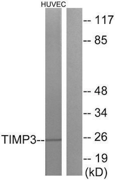 Anti-TIMP3 antibody produced in rabbit affinity isolated antibody