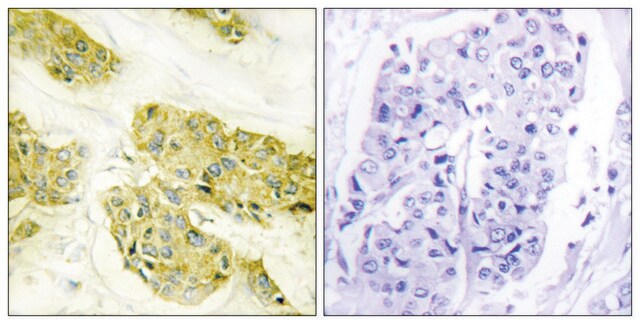 Anti-Collagen V &#945;3 antibody produced in rabbit affinity isolated antibody