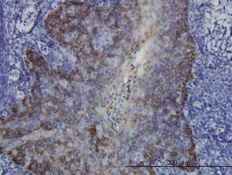 Monoclonal Anti-KRT17 antibody produced in mouse clone 2D4-1G9, purified immunoglobulin, buffered aqueous solution