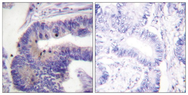 抗PDE4D抗体 ウサギ宿主抗体 affinity isolated antibody