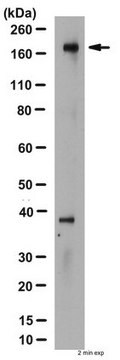 Anti-CFTR Antibody, a.a. 1370-1380, clone M3A7 clone M3A7, Chemicon&#174;, from mouse