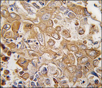 Anti-LECT1 (N-term) antibody produced in rabbit saturated ammonium sulfate (SAS) precipitated, buffered aqueous solution