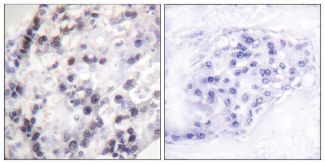 Anti-HNRNP C1 antibody produced in rabbit affinity isolated antibody