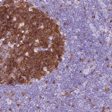 Anti-SPC25 antibody produced in rabbit Prestige Antibodies&#174; Powered by Atlas Antibodies, affinity isolated antibody, buffered aqueous glycerol solution