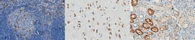 Anti-TERT Antibody, clone 7D5.2 clone 7D5.2, from mouse