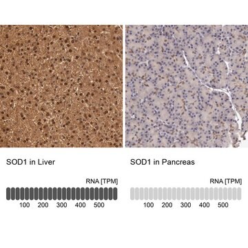 Anti-SOD1 antibody produced in rabbit Prestige Antibodies&#174; Powered by Atlas Antibodies, affinity isolated antibody, buffered aqueous glycerol solution