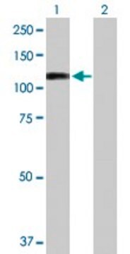 Anti-RECK antibody produced in rabbit purified immunoglobulin, buffered aqueous solution