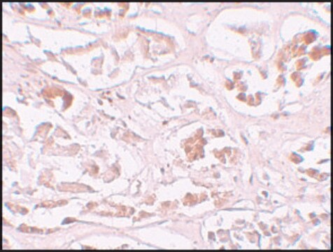 Anti-ALKBH2 antibody produced in rabbit affinity isolated antibody, buffered aqueous solution