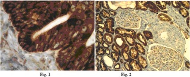 Anti-IL-13 receptor Antibody, alpha-2 (IL-13RA2) from rabbit, purified by affinity chromatography