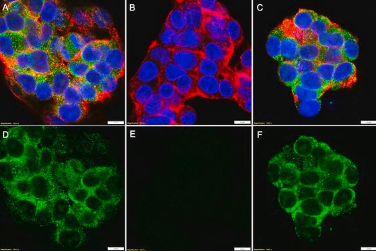 Anti-p-JAK3 (Tyr980/981) Antibody, clone 2D9 ZooMAb&#174; Rabbit Monoclonal recombinant, expressed in HEK 293 cells