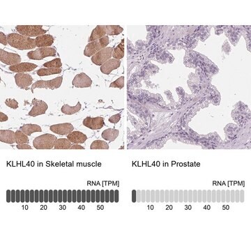 Anti-KLHL40 antibody produced in rabbit Prestige Antibodies&#174; Powered by Atlas Antibodies, affinity isolated antibody, buffered aqueous glycerol solution