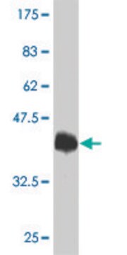 Monoclonal Anti-TRPV1 antibody produced in mouse clone 1F5, purified immunoglobulin, buffered aqueous solution